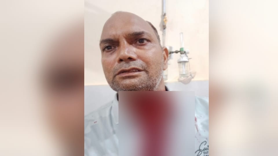 चाइनीज मंझे  घायल हुआ शख्स, गर्दन में कई टांके आए