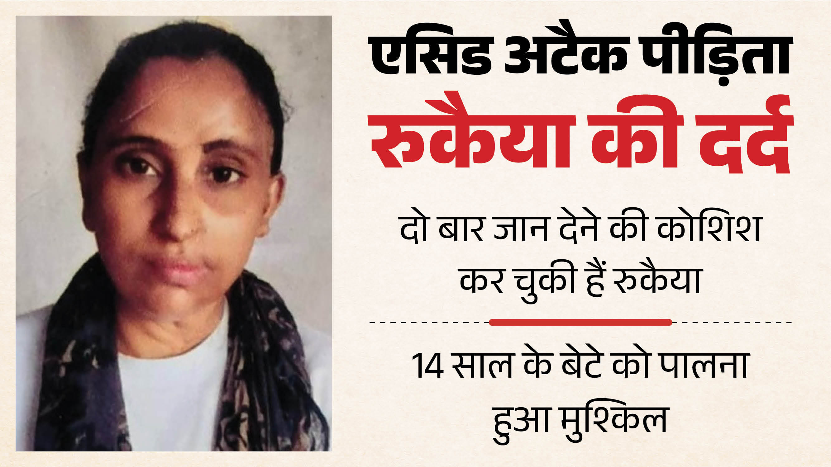 Acid attack survivor