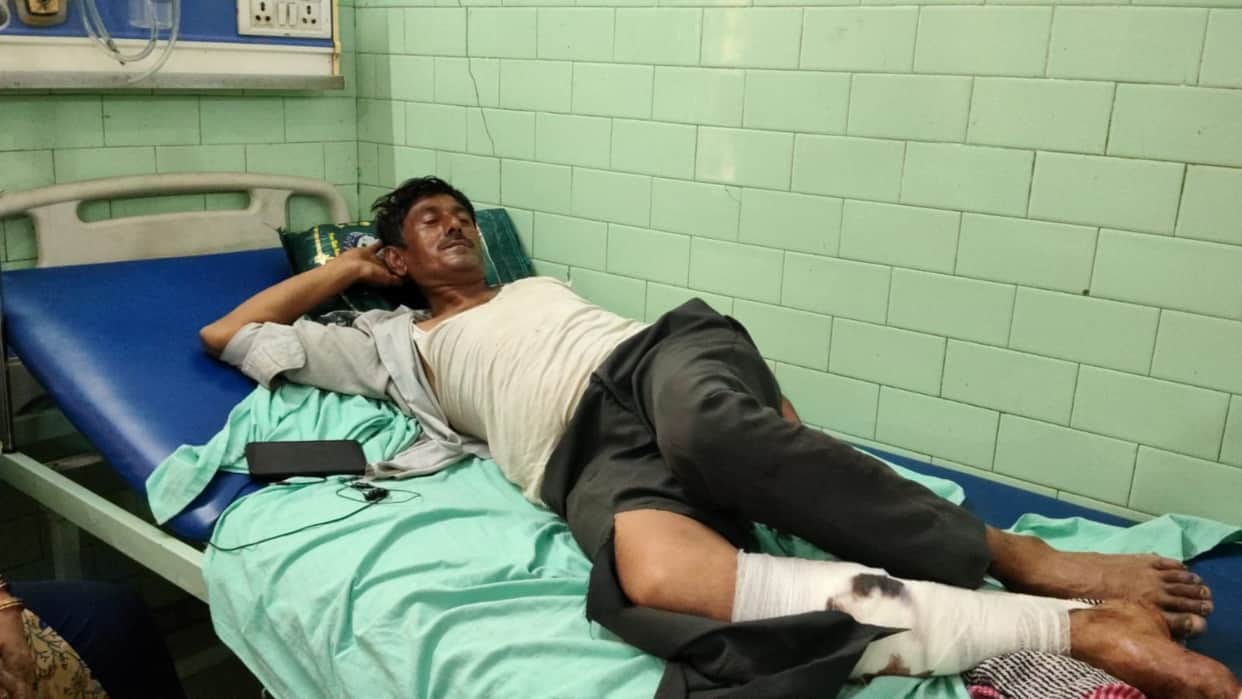 Passenger suffers leg fracture after being hit by a stone on a moving train