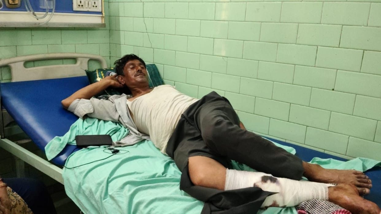 Passenger suffers leg fracture after being hit by a stone on a moving train