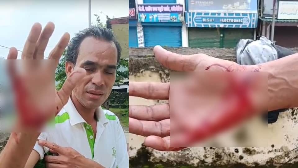 कुत्ते ने काटा