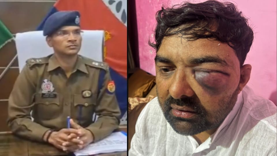 Meerut: Forced to dance to the song 'Choli Ke Peeche Kya Hai', kicked in the eye