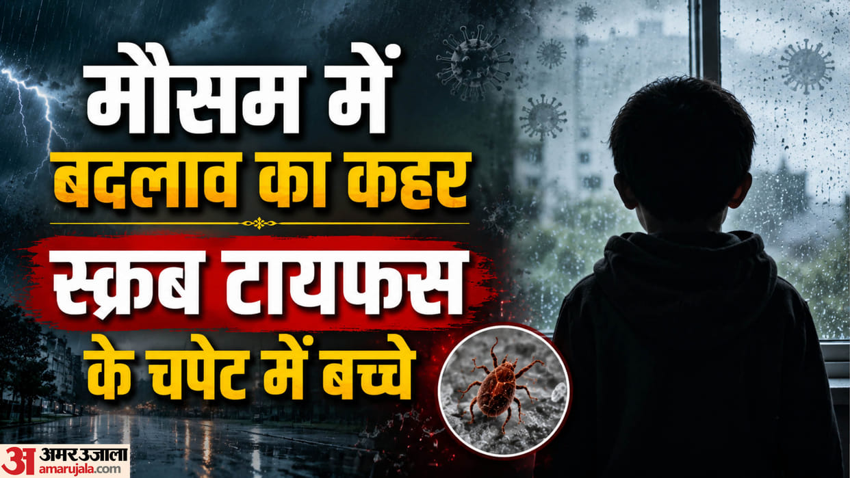Scrub Typhus in varanasi Five children treated at BHU in 15 days symptoms observed alongside viral fever