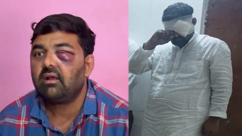 Meerut: Dalit Leaders Digvijay Bhati and Mohit Jatav Allege Custodial Assault, Serious Charges Against Police