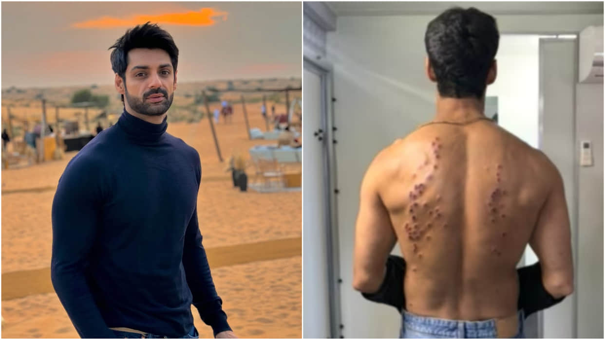 Khatron Ke Khiladi 15 Karan Wahi Said My Mind Went Numb Recalling The Pellet Gun Task