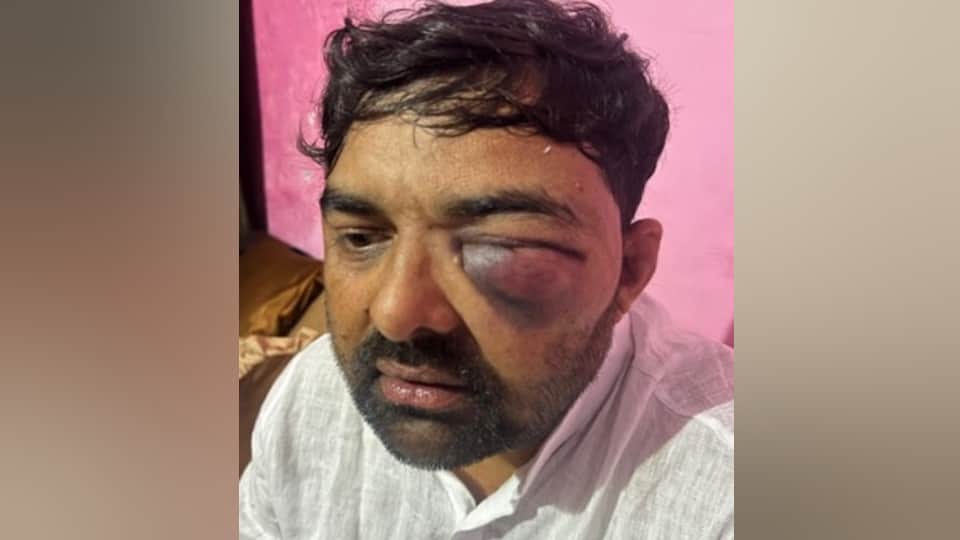 Meerut: Inspector and several SOG police personnel under scrutiny in assault case