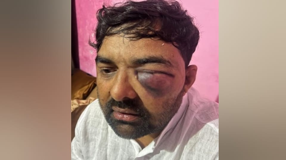 Meerut: Inspector and several SOG police personnel under scrutiny in assault case