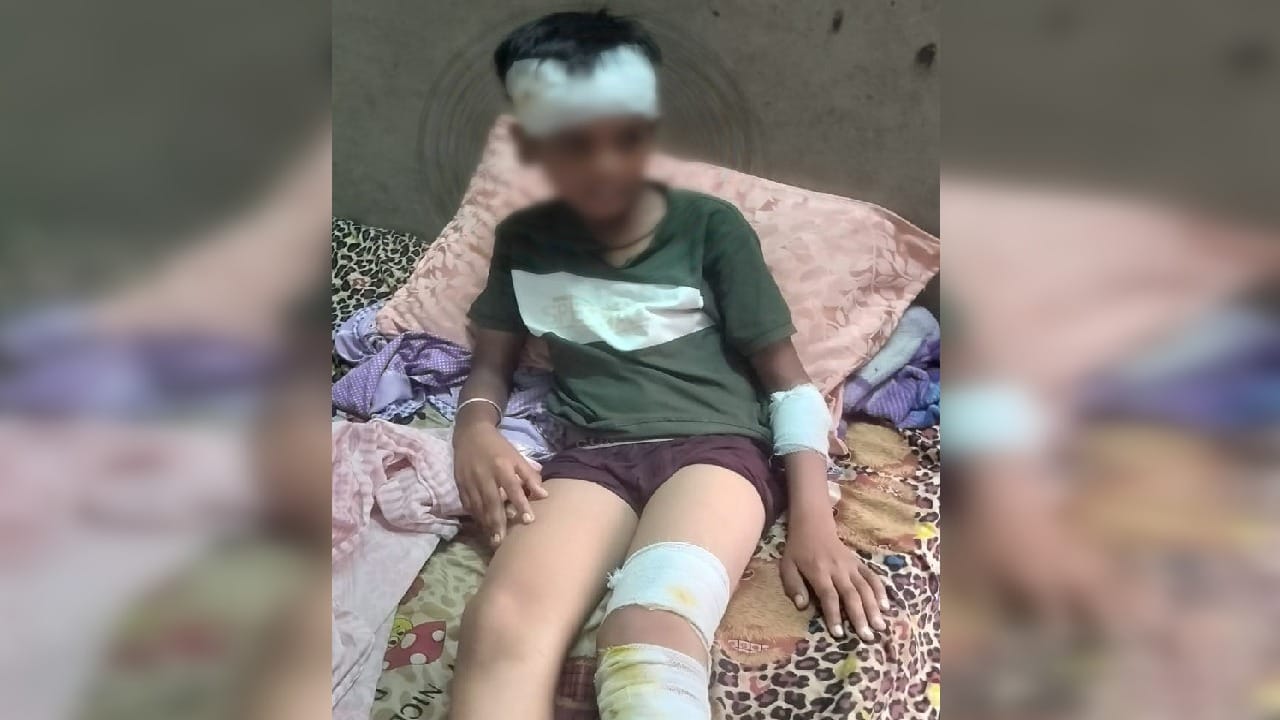 छात्र पर कुत्ते ने किया हमला