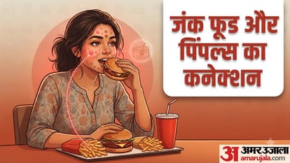 जंक फूड खाने के बाद चेहरे पर क्यों निकल आते हैं पिंपल्स?