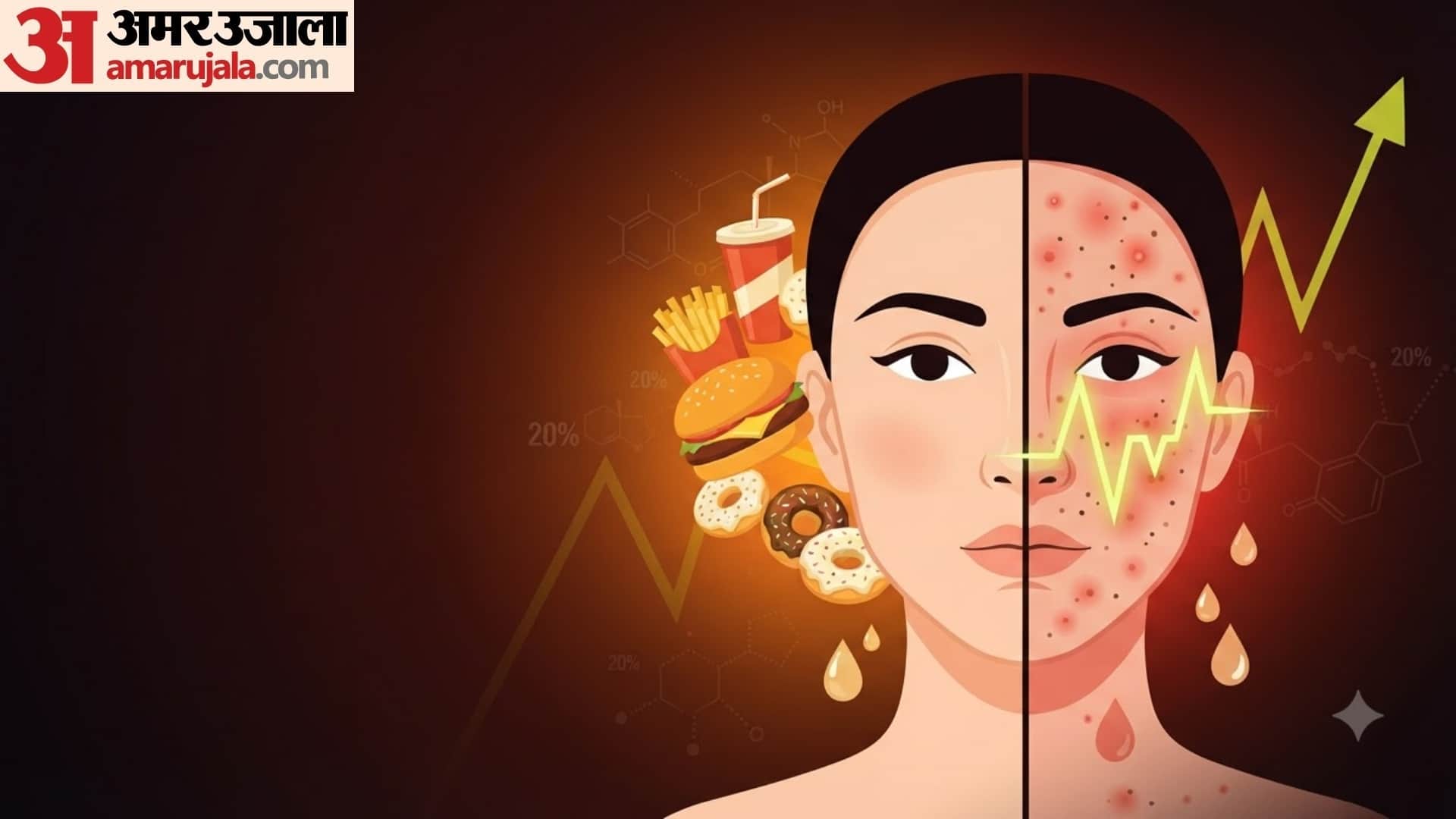 why do i get pimples after eating junk in hindi kya oily khane se pimple hota hai