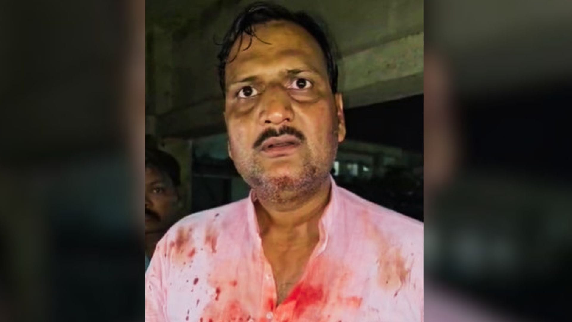 मुगलसराय कोतवाली के बाहर लहुलूहान हाल में प्रदेश महामंत्री।