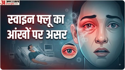 स्वाइन फ्लू का आंखों पर असर