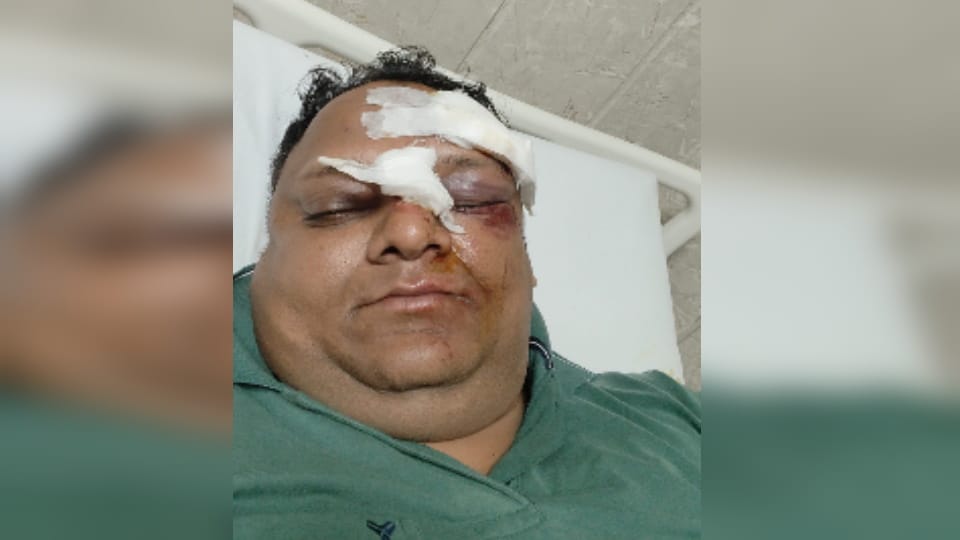 Meerut: Four Youths on Scooters Allegedly Assault Man on West End Road, CCTV Being Scanned
