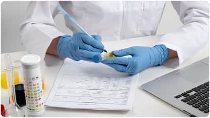 what is Lipoprotein a Hidden Cholesterol Risk That Linked to Heart Attack and Stroke