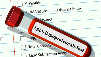 what is Lipoprotein a Hidden Cholesterol Risk That Linked to Heart Attack and Stroke