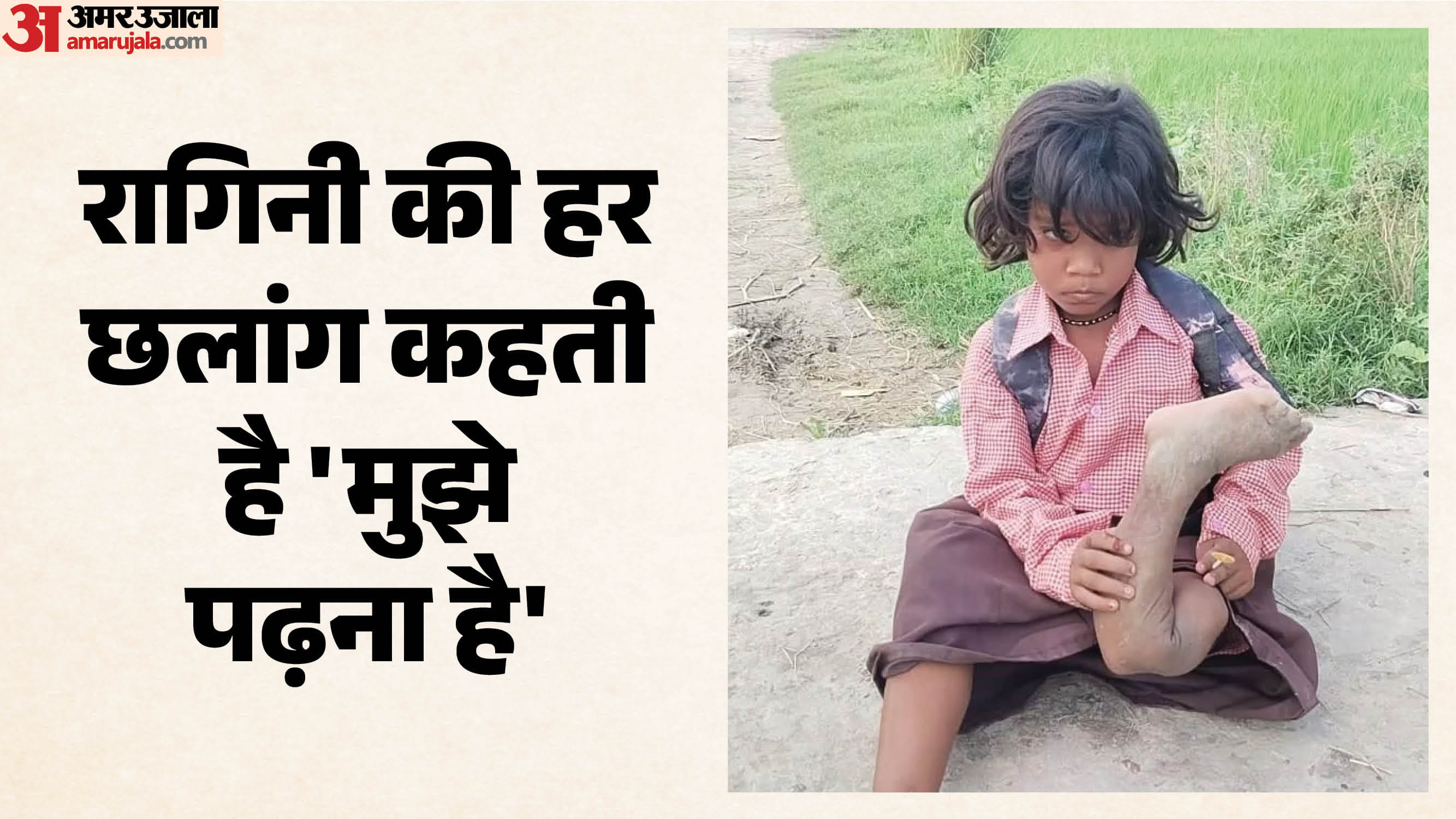 एक पैर से दिव्यांग रागिनी एक पैर से छलांग लगाकर जाती है स्कूल