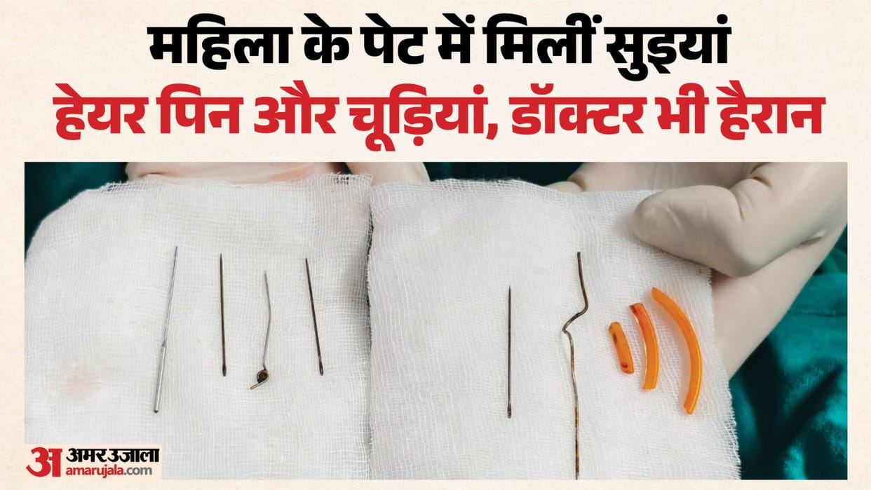 SRN Hospital: Miracle in the City of Sangam; doctors extract needles and hairpins from a patient's stomach.