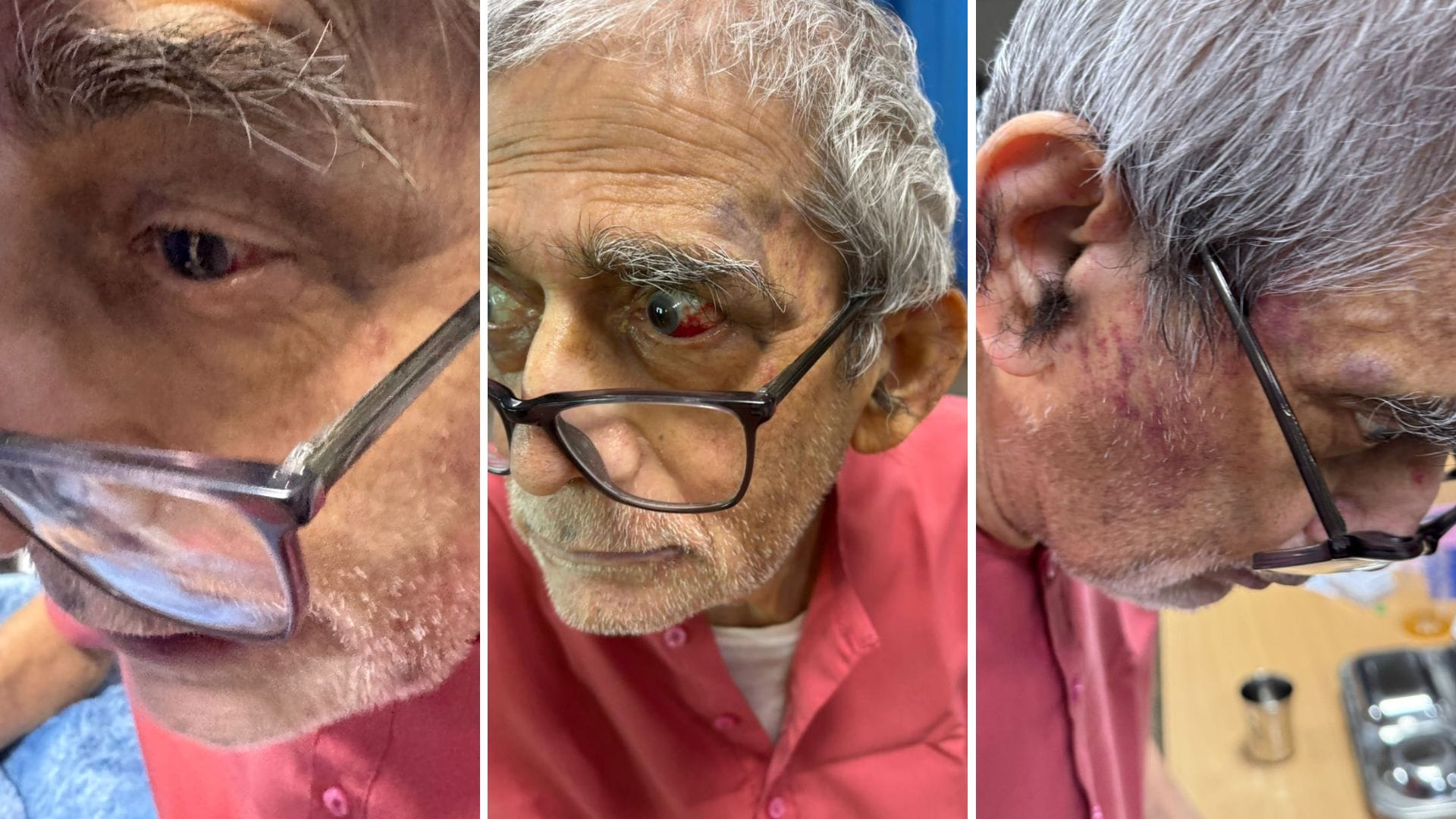 प्रोफेसर और पद्मश्री प्रो.टीके लहरी घायल हुए।