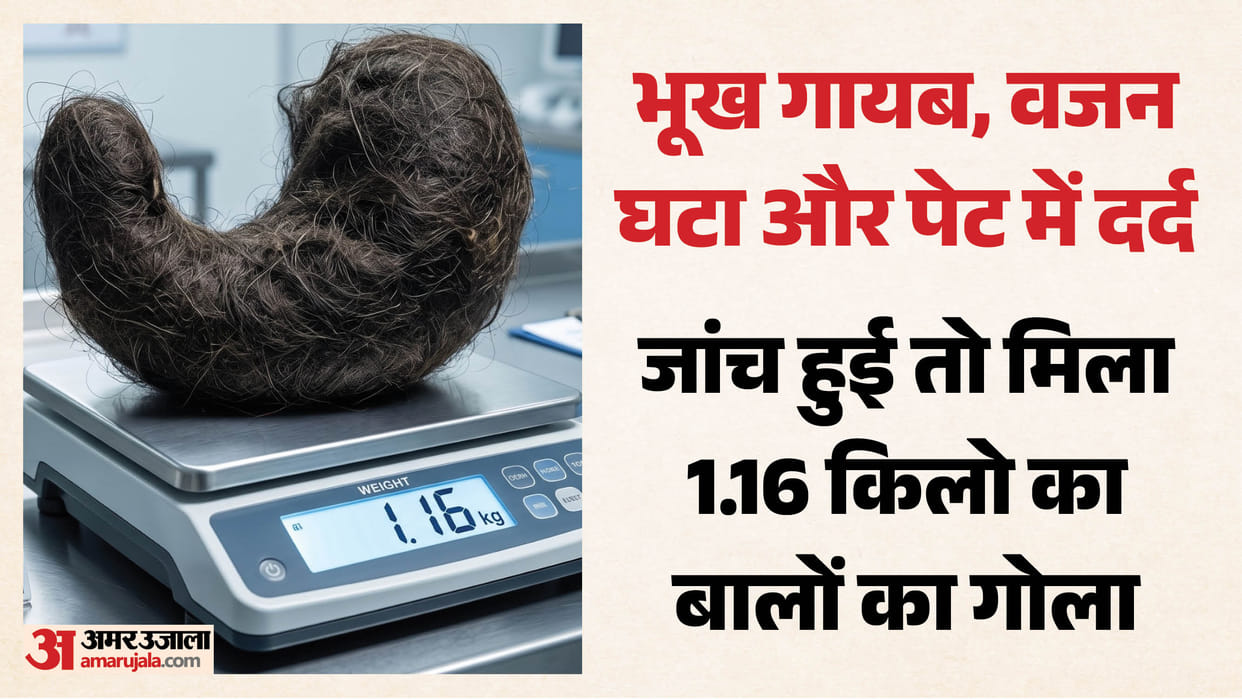 Girl ate hair for 11 years 1.16 kg ball formed in her stomach