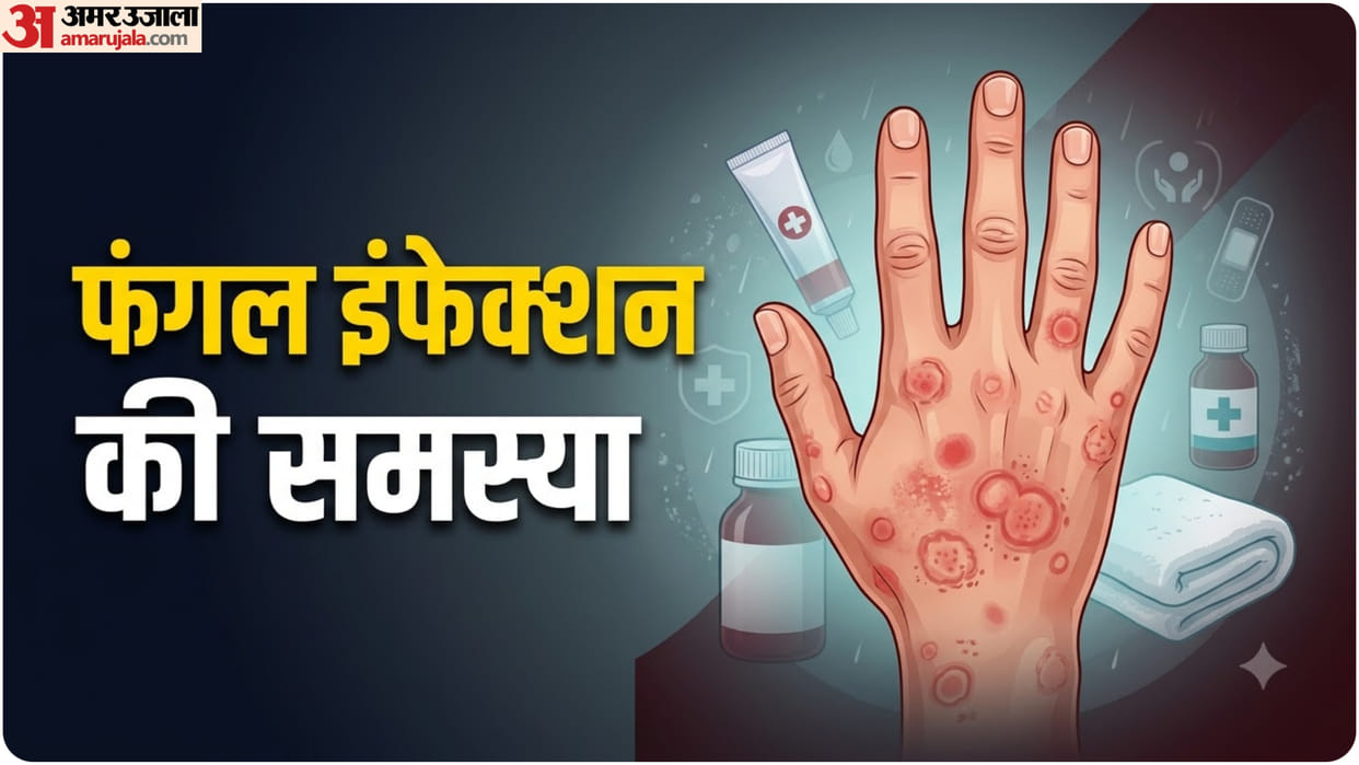 How to Prevent Fungal Infections in Hot and Humid know Home Remedies