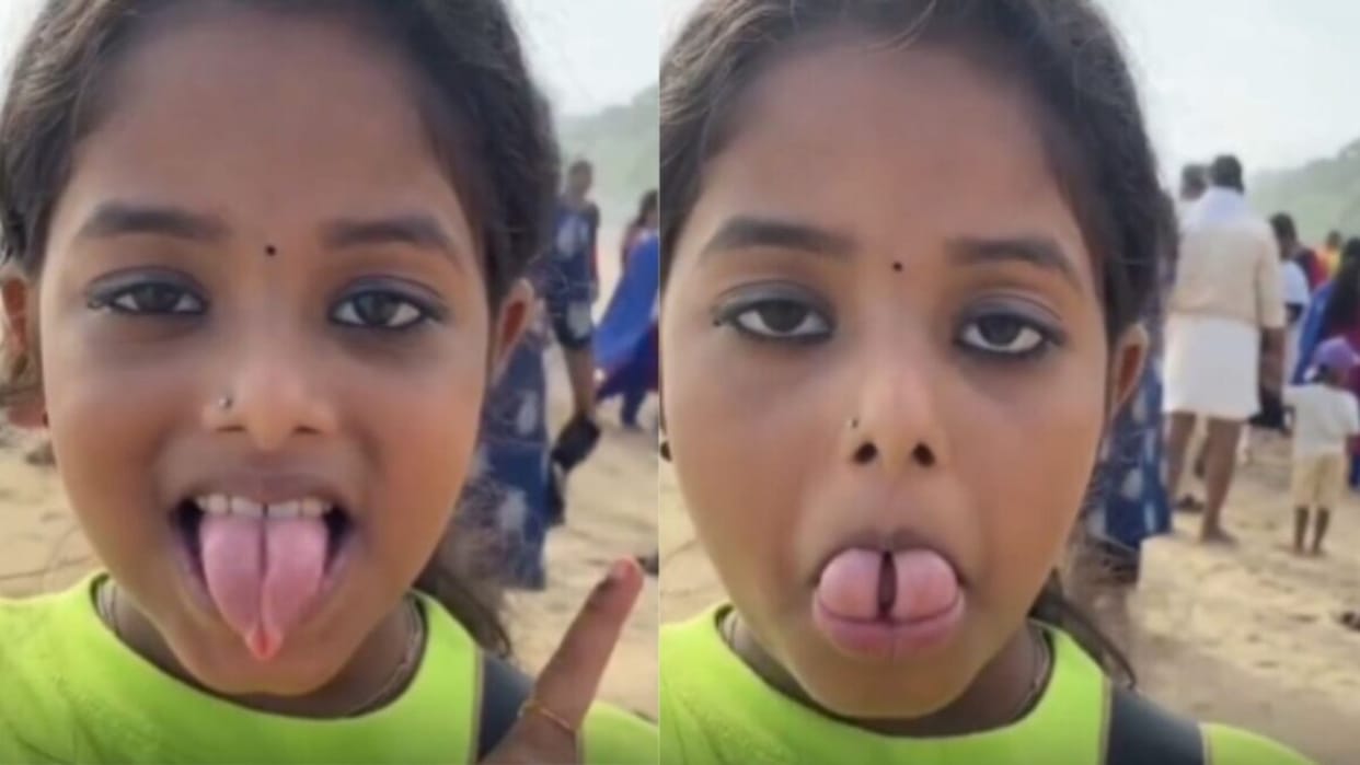 viral kerala girl tongue flexibility nose chin viral video gorlin sign shocking moment on internet