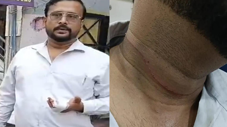 Kanpur: Private bank officer injured by 'Chinese manjha'; neck snagged and finger slashed