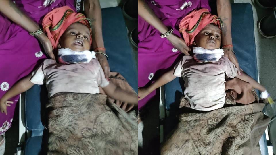 तेंदुए के हमले में घायल बच्ची।