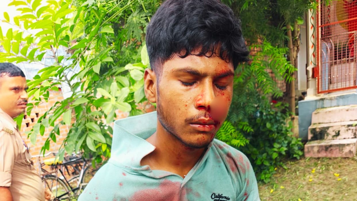 Varanasi Gun goes off while filming reel 16-year-old boy injured two companions detained