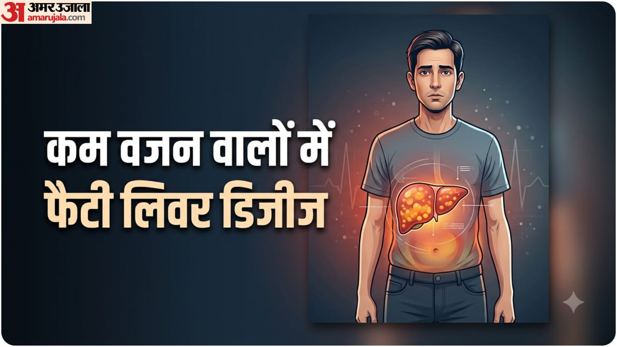 Can Thin People Develop Fatty Liver risk of  Fatty Liver Without Obesity