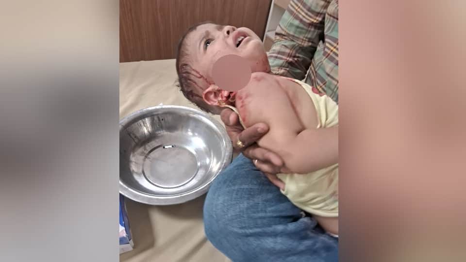 Stray dog menace in Firozpur Cantt Toddler mauled