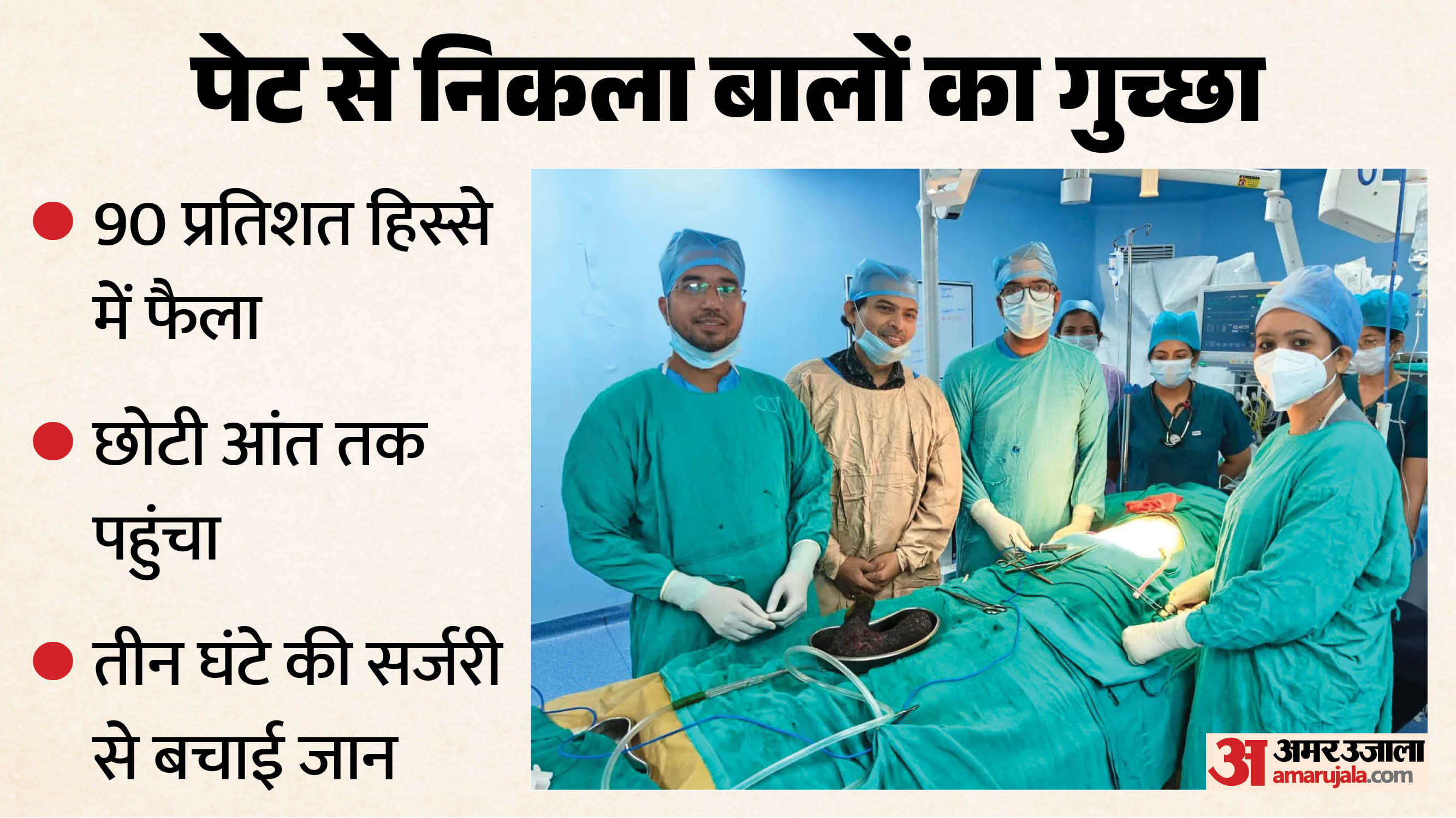 यह गुच्छा पेट के करीब 90 प्रतिशत हिस्से में फैला हुआ था