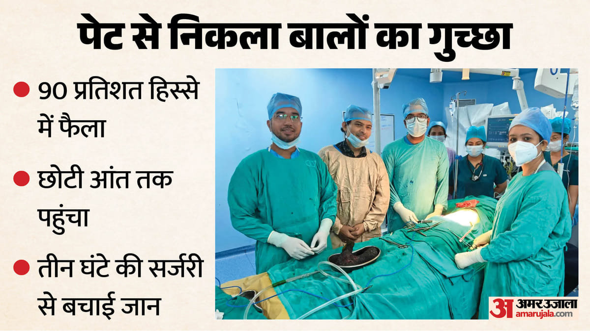 शिवपुरी: पेट में बना ‘बालों का पहाड़’, 14 साल की बच्ची की हालत बिगड़ी तो ऑपरेशन में सामने आया चौंकाने वाला सच