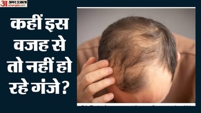 गंजापन