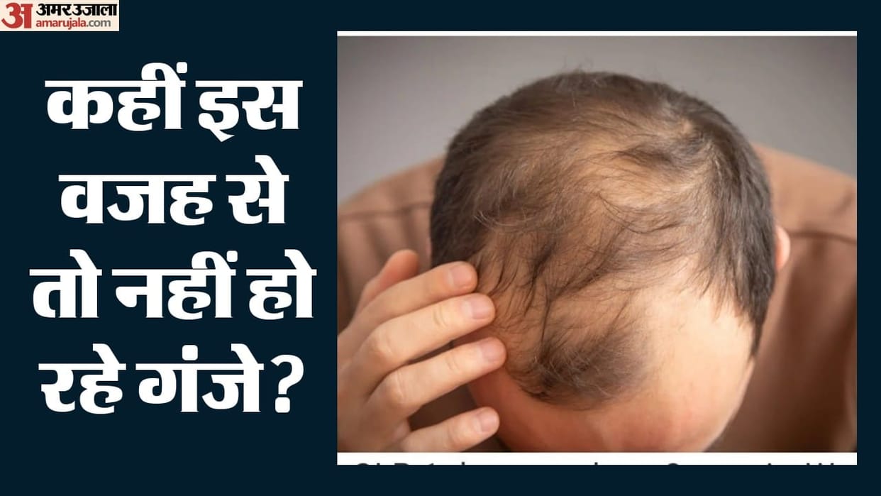 ozempic wegovy zepbound hair loss risk genetic baldness