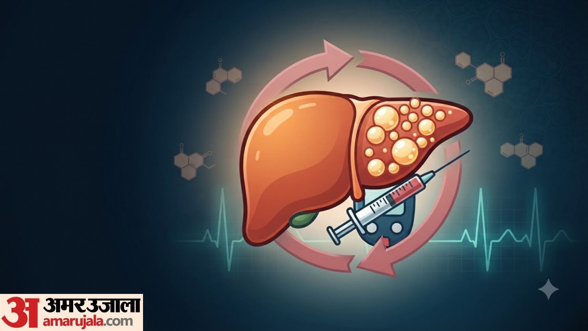 connection between diabetes and fatty liver in hindi kya fatty liver walo ko diabetes hota hai