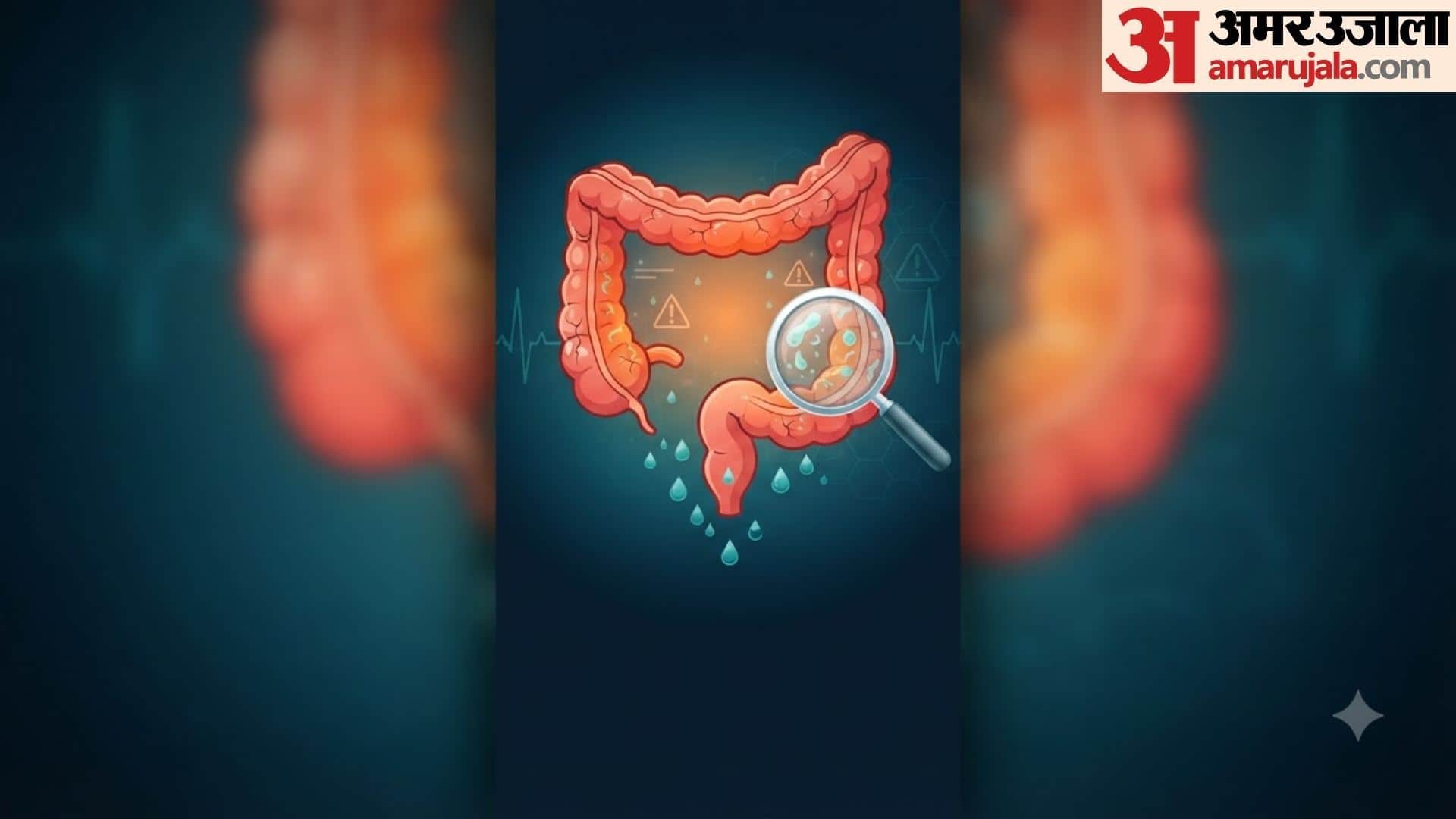 symptoms of swelling in large intestine in hindi badi aant me sujan ke lakshan