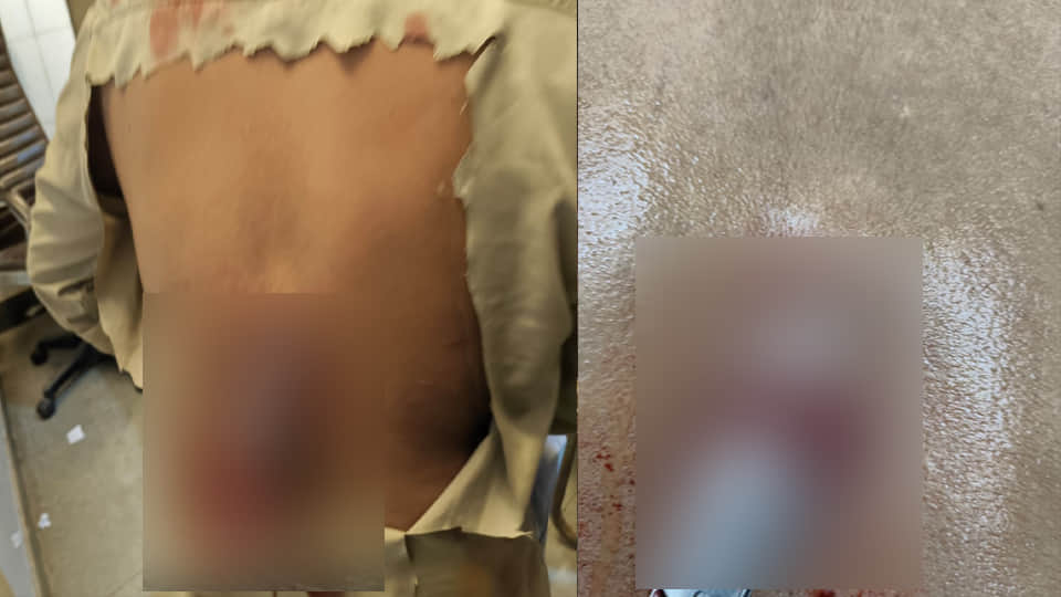 Chitrakoot: Youth attacked with a knife in a life-threatening assault at Shankar Bazaar; condition critic