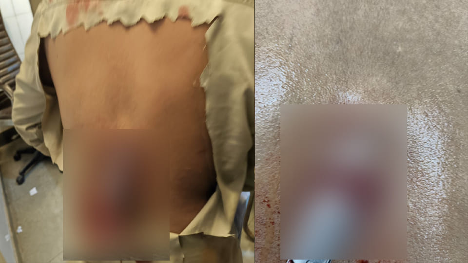 Chitrakoot: Youth attacked with a knife in a life-threatening assault at Shankar Bazaar; condition critic