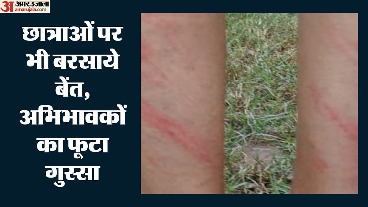 राजोरी: स्कूल में यूनिफॉर्म पहनकर न आने पर छात्रों को बेरहमी से पीटा, टांगों पर पड़े लाल निशान; शिक्षक निलंबित