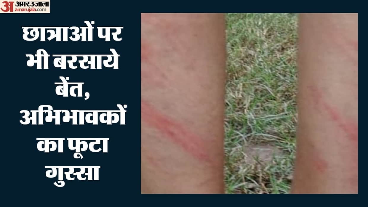 Rajouri: Student brutally beaten for not wearing school uniform; teacher suspended