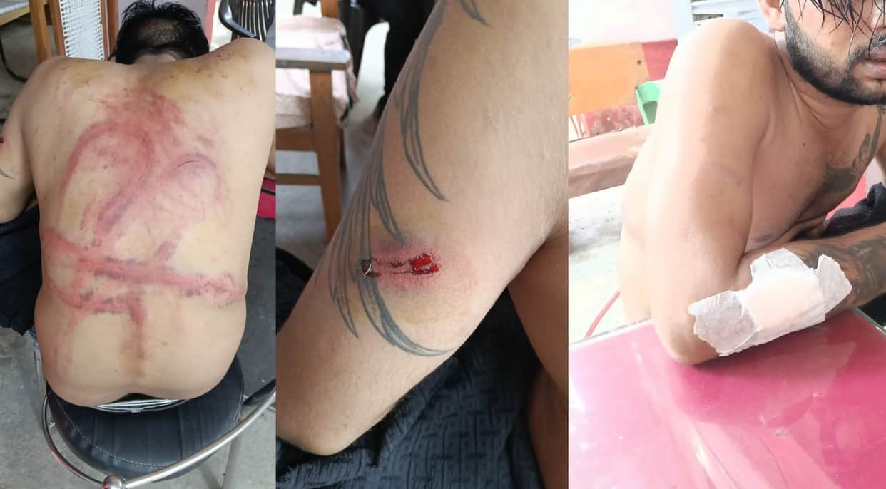 Kanpur Young man brutally beaten at Hotel Grand struck with iron rods and belts hit on the head with a brick