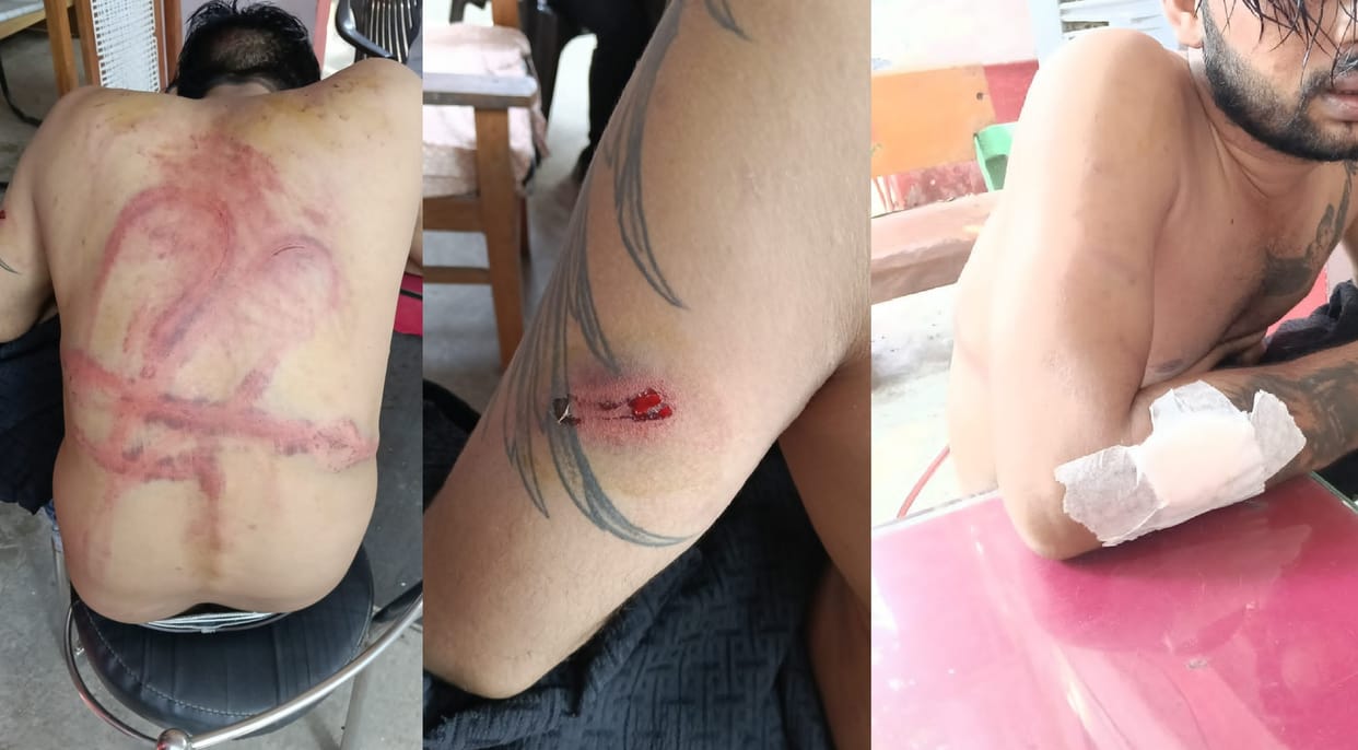Kanpur Young man brutally beaten at Hotel Grand struck with iron rods and belts hit on the head with a brick