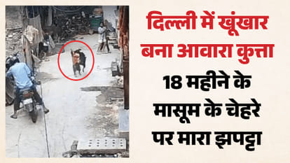 मासूम पर आवारा कुत्ते का हमला