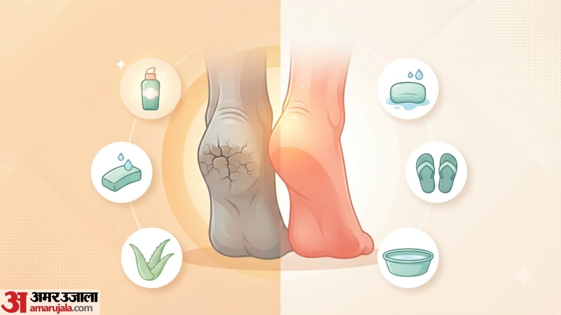 home remedies for cracked heels and dry feet fati edi ko kaise theek karen gharelu upay
