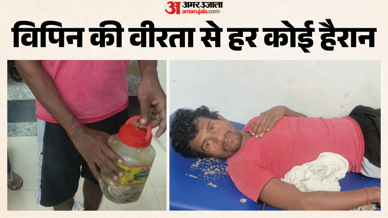 man remained calm even after being bitten by snake took snake to hospital in a box
