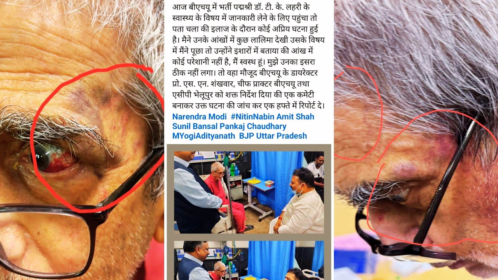 डॉ. टीके लहरी को थप्पड़ मारने से संबंधित वीडियो वायरल।