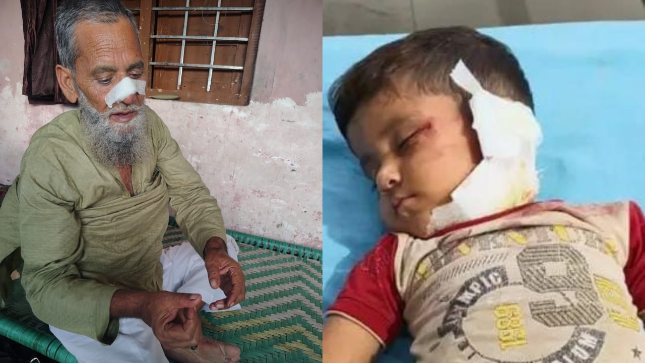 कुत्तों के हमले में घायल हुए बुजुर्ग और बच्चा