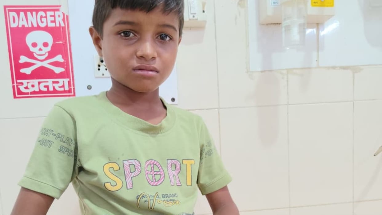 Monkeys attacked a nine-year-old boy and biting him on the leg in Bareilly