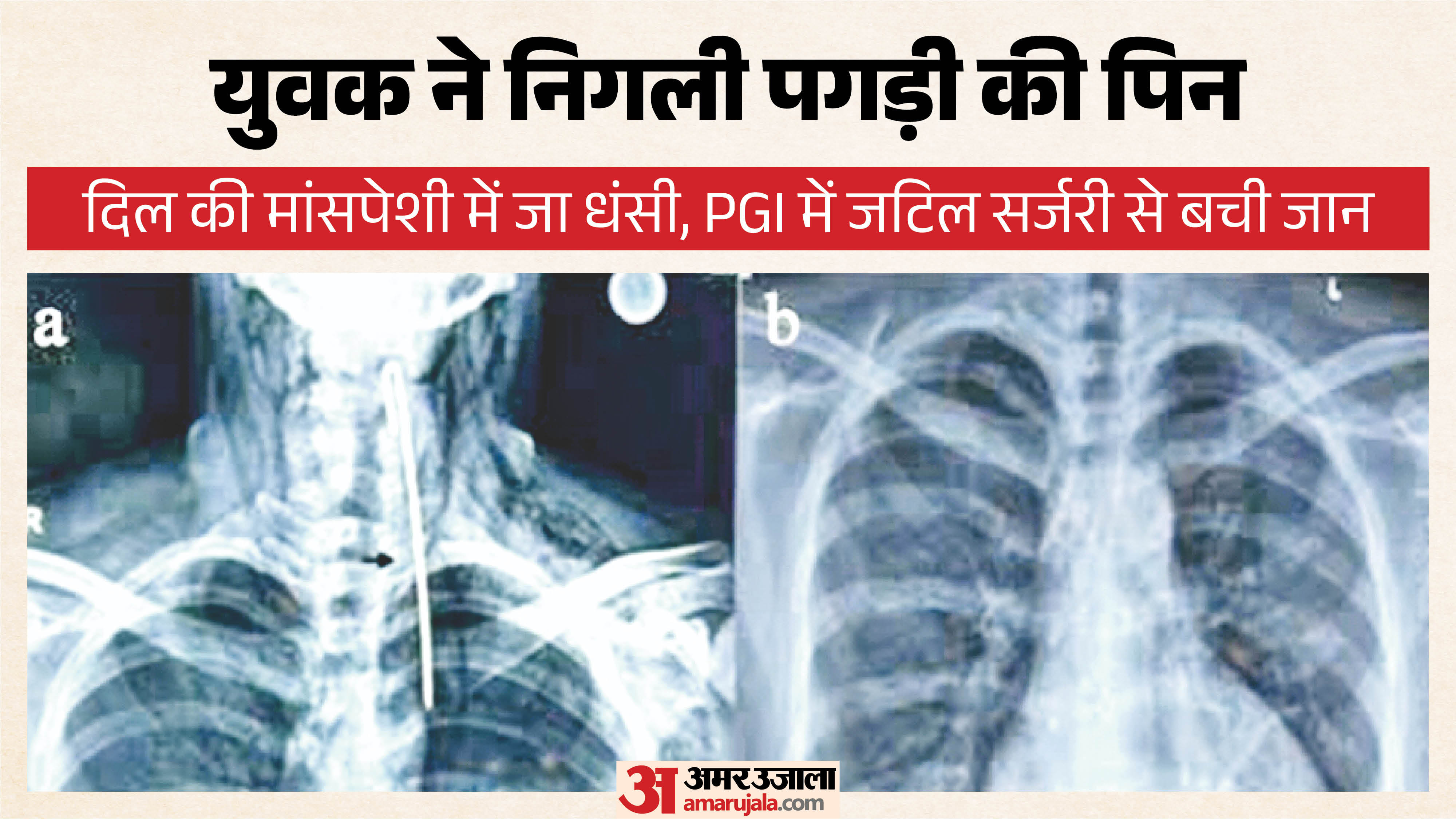 दिल में फंसी पिन