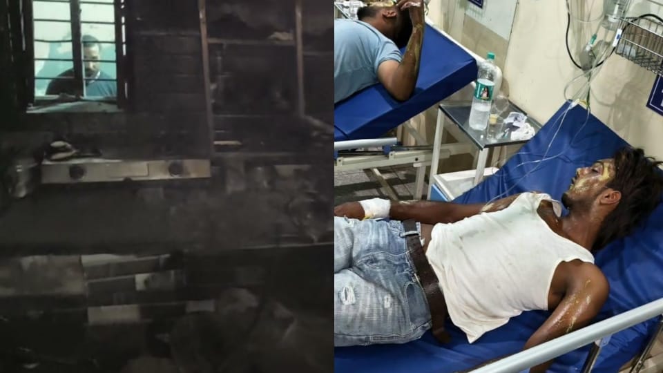 आग से जला किचन और अस्पताल में भर्ती झुलसे युवक।